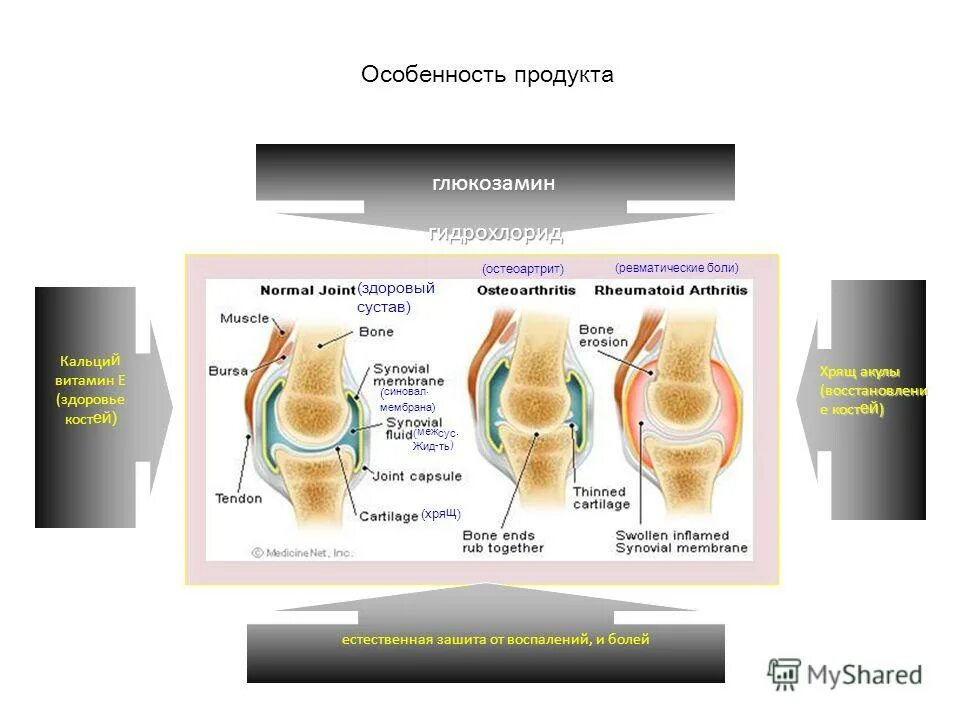хрящи в пищу