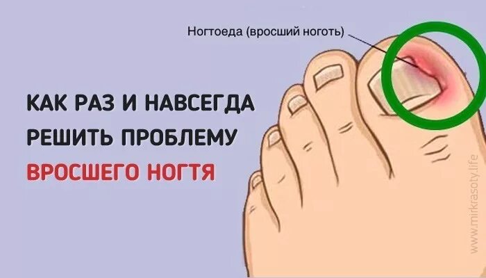 Раз и навсегда решит проблему