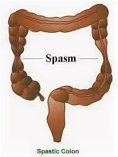 Просвет кишки спазмирован.
