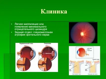 Циркляж
