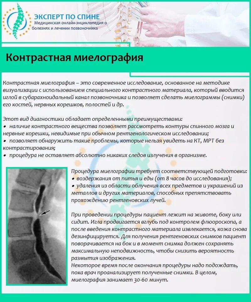 Протрузия лечение препараты. Миелография позвоночника что это такое. мрт позвоночника протрузия. миелография спинного мозга. препараты от протрузии дисков.