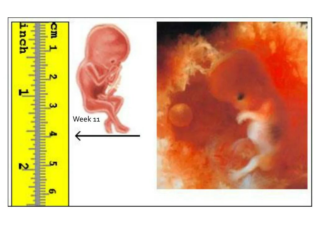 Эмбрион на 11 неделе беременности фото. 12 Недель беременности размер плода. Размер ребенка на 12 неделе. Сколько будет 11 недель