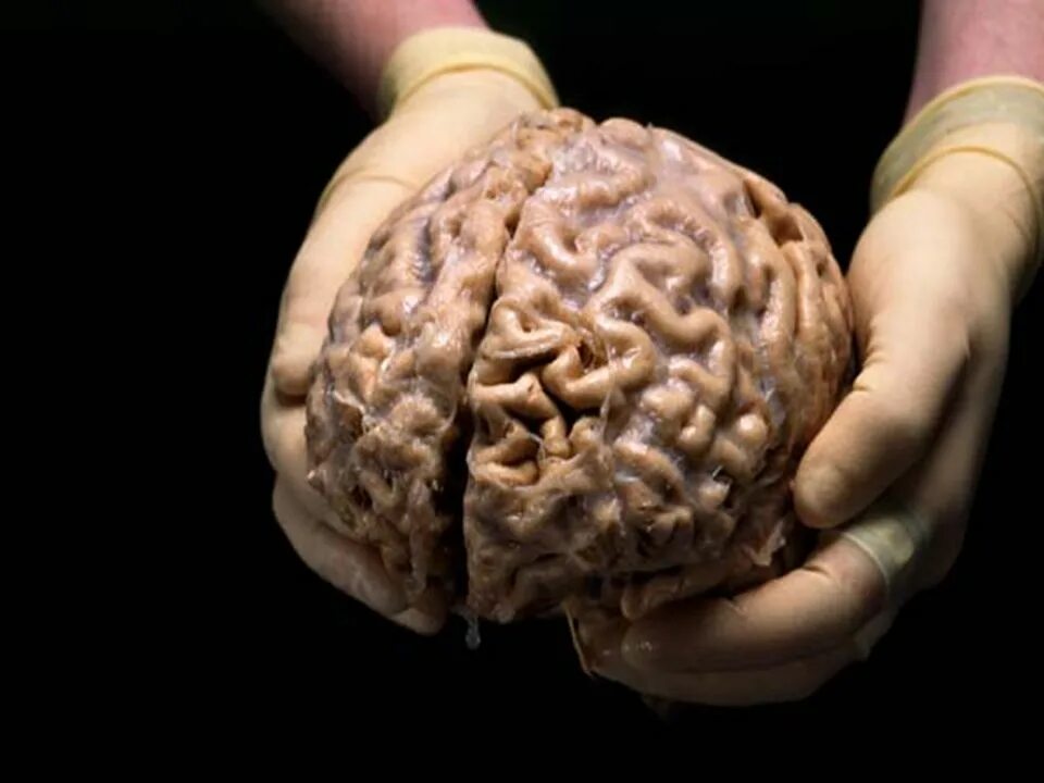 Brain mass. Brain mass