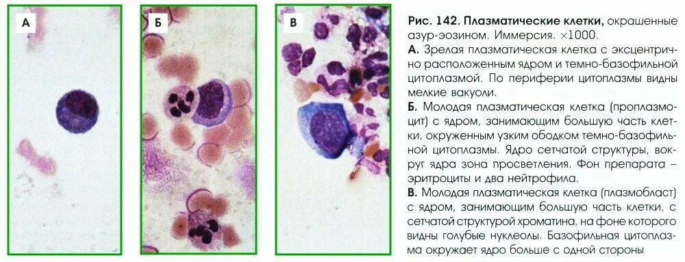 Плазматические клетки в периферической крови. Анализ крови плазматические клетки норма. Плазматические клетки в анализе. Плазматические клетки гистология. Плазматические клетки в крови.