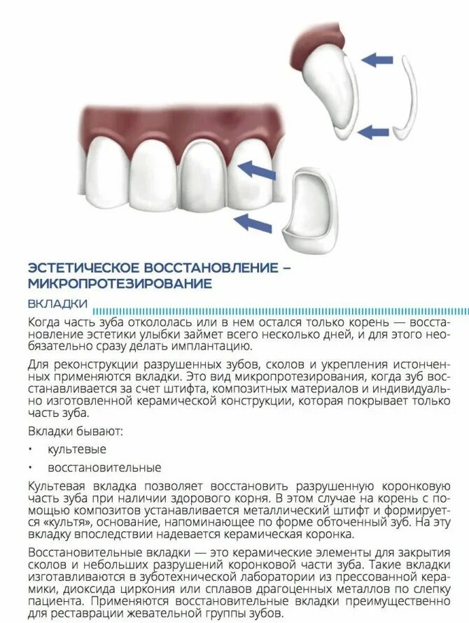 Можно ли после удаления зуба пить кофе. Съемный микропротез 1 зуб. Виды зубных протезов восстанавливающих анатомическую форму зубов. Классификация несъемных протезов ортопедическая стоматология. Конструкция протеза зубов.