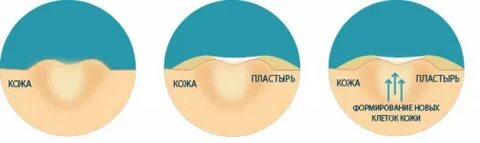 Кожа после пластыря