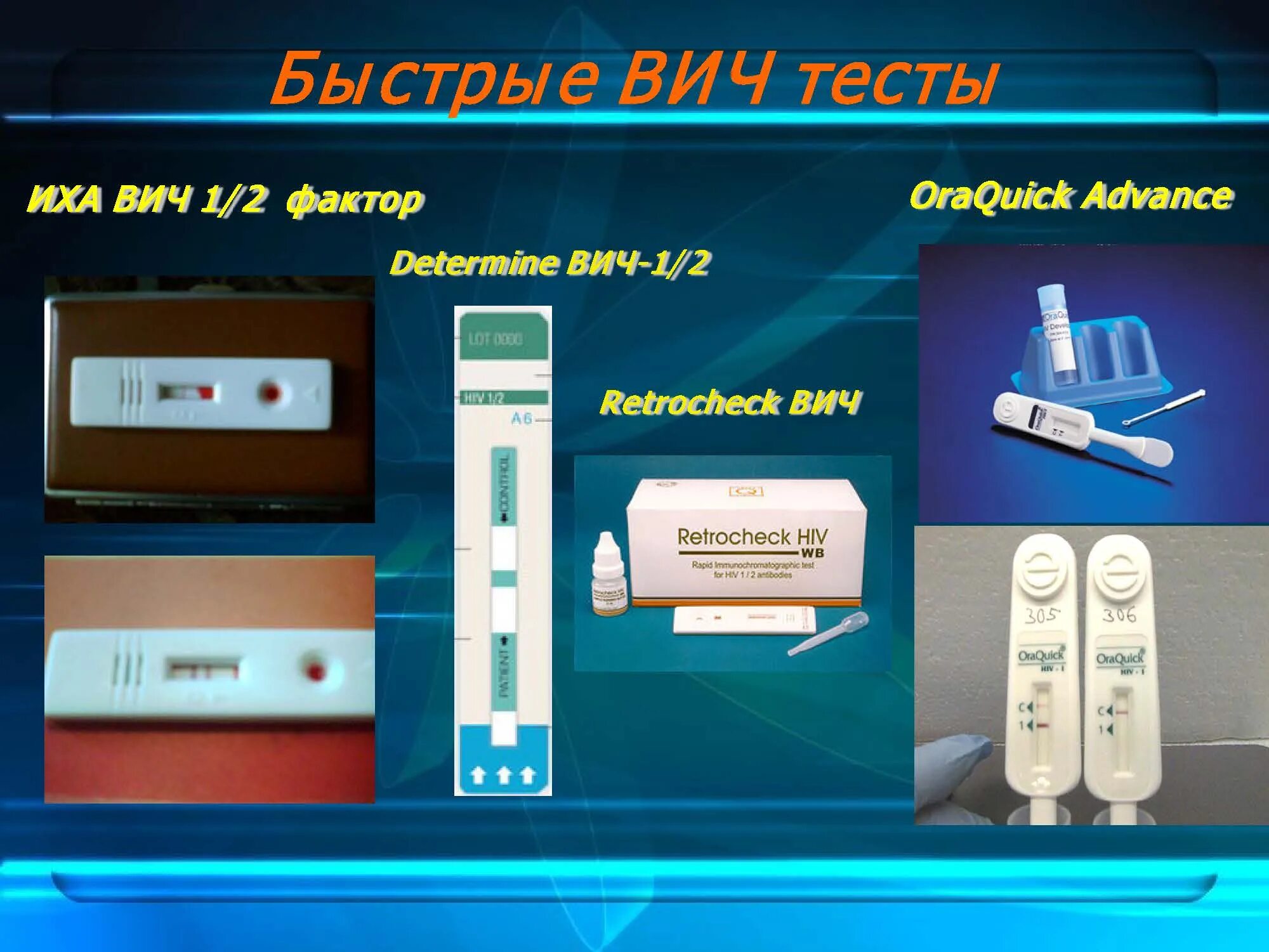 Качественно иммунохроматографический тест. Иммунохроматографический тест на ВИЧ. Иммунохроматографические экспресс-тесты. Иммунохроматографический анализ. ИХА ВИЧ.