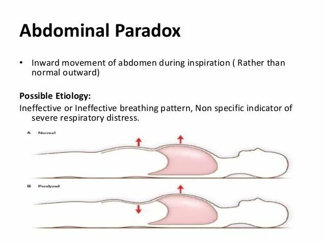 Sly johns lab paradoxical. Paradoxical outcome.