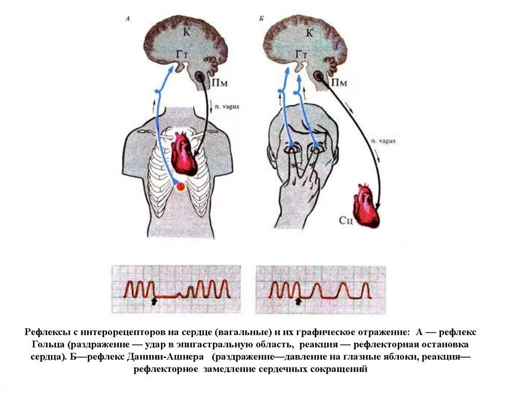 Данини Ашнера рефлекс механизм. Рефлекс гольца и Данини-Ашнера. Рефлекс Данини Ашнера схема. Рефлекторный путь рефлекса Данини-Ашнера.