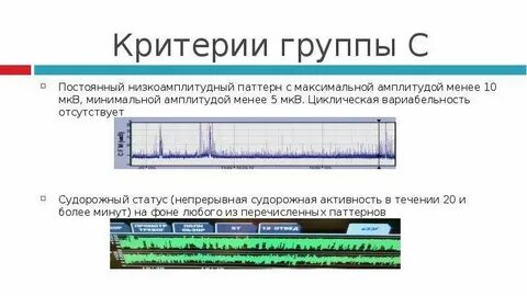 Амплитуда нижний