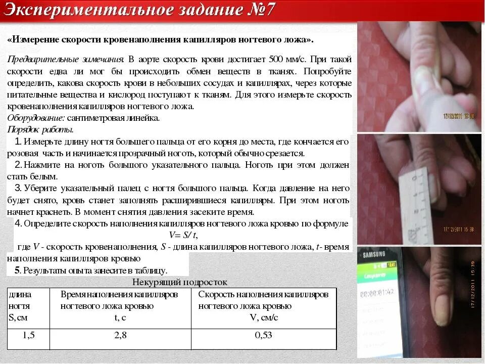 Лабораторная работа опыт доказывающий что пульс связан. Измерение скорости кровотока в сосудах ногтевого ложа. лабораторная работа измерение скорости кровотока в сосудах. а изменение скорости наполнения сосудов ногтевого ложа. определение скорости кровотока в сосудах ногтевого ложа.