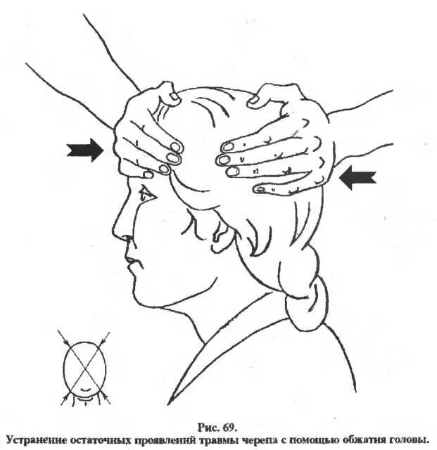 Массаж головы схема. Правка головы при сотрясении. Правка головы после сотрясения. Массаж головы техника выполнения. Давление при травме головы
