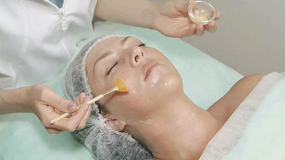 Алмазная микродермабразия hydrafacial. Алмазная шлифовка лица от постакне. Пилинг ростов. Косметические процедуры. Пилинг для лица.