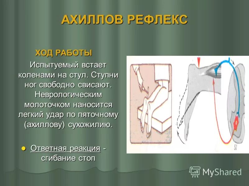 Лабораторная работа рефлекс