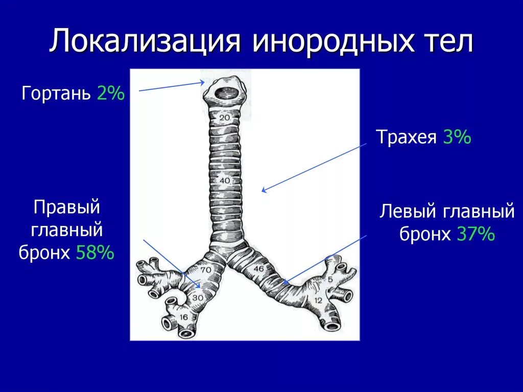 Инородные Тела Трахеи Бронхов