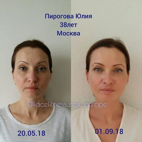 Морщины улыбки. Кожа 38 лет. Морщины на лице. Морщины на лице у женщин. Ухоженная женщина.