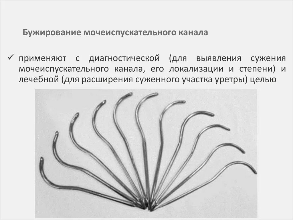 Сужение мочеиспускательного канала. Инструмент для бужирования уретры. Цистоскопическое бужирование. Бужирование уретры у мужчин. Бужирование уретры у женщин.