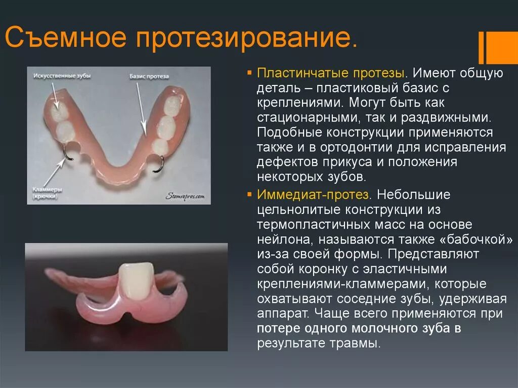 Съемный пластиночный протез показания