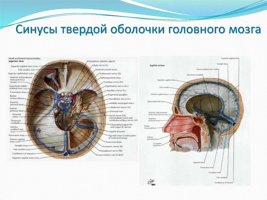 Синусы оболочек головного мозга. Поперечный синус твердой мозговой оболочки. Сигмовидный синус твердой оболочки. Прямой синус твердой мозговой оболочки. Сигмовидный синус твердой мозговой оболочки.