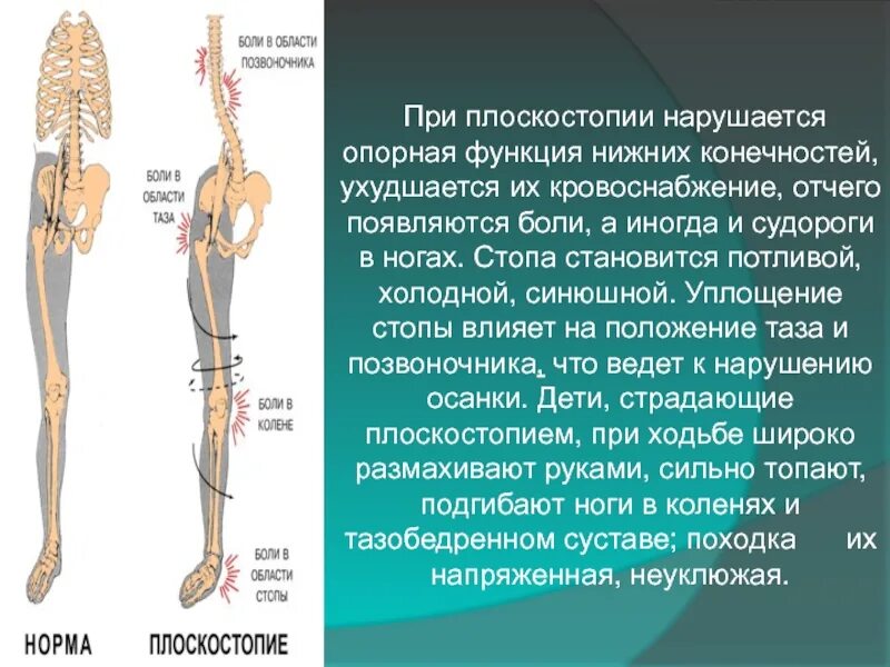 Функции нижних конечностей. Плоскостопие. Плоскостопие и позвоночник. Мышечное плоскостопие.