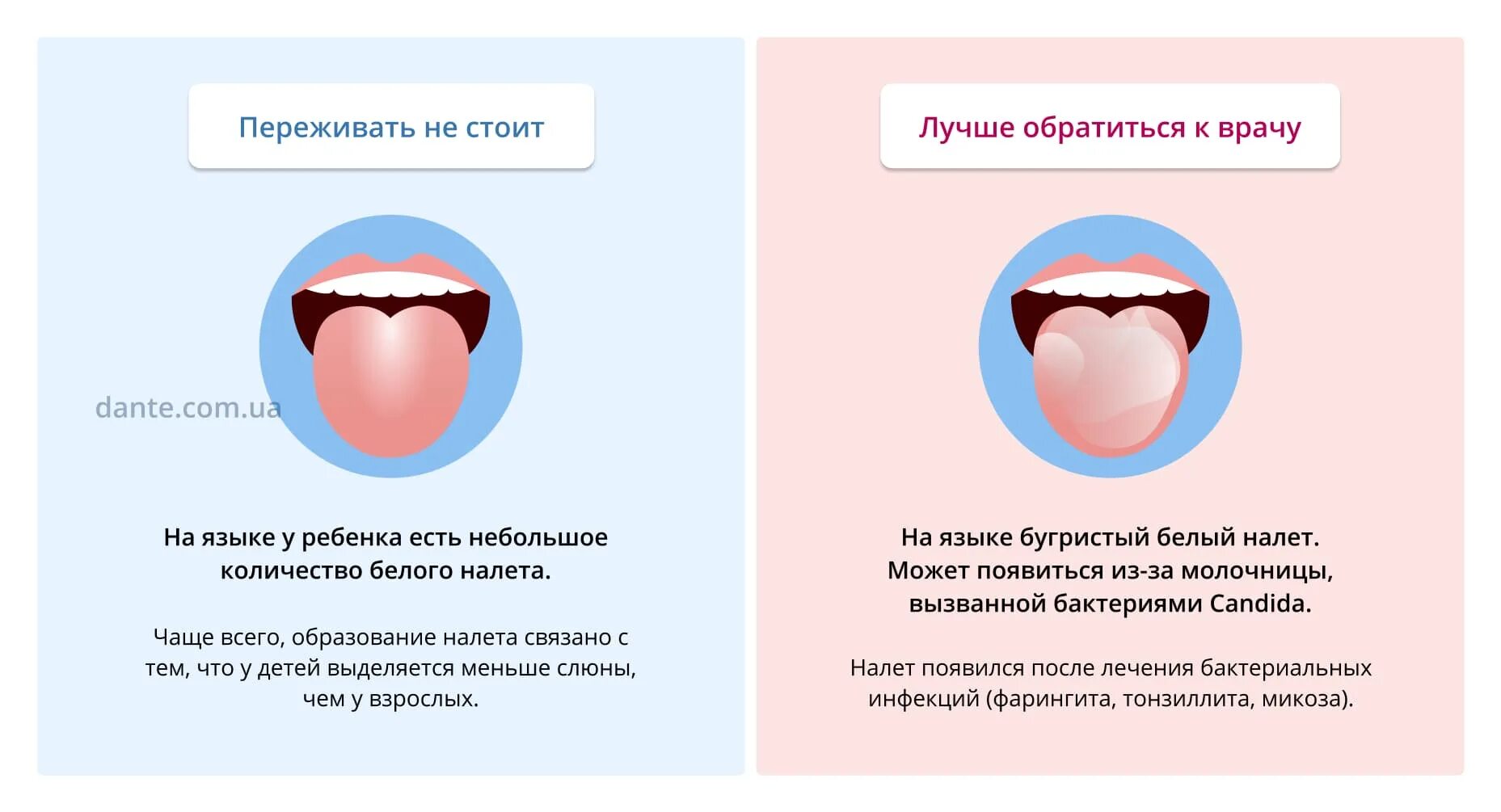 Какой язык при температуре. Язык белый налет на языке.