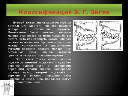 Ортодонтия классификация