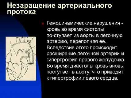 Незаращение протока