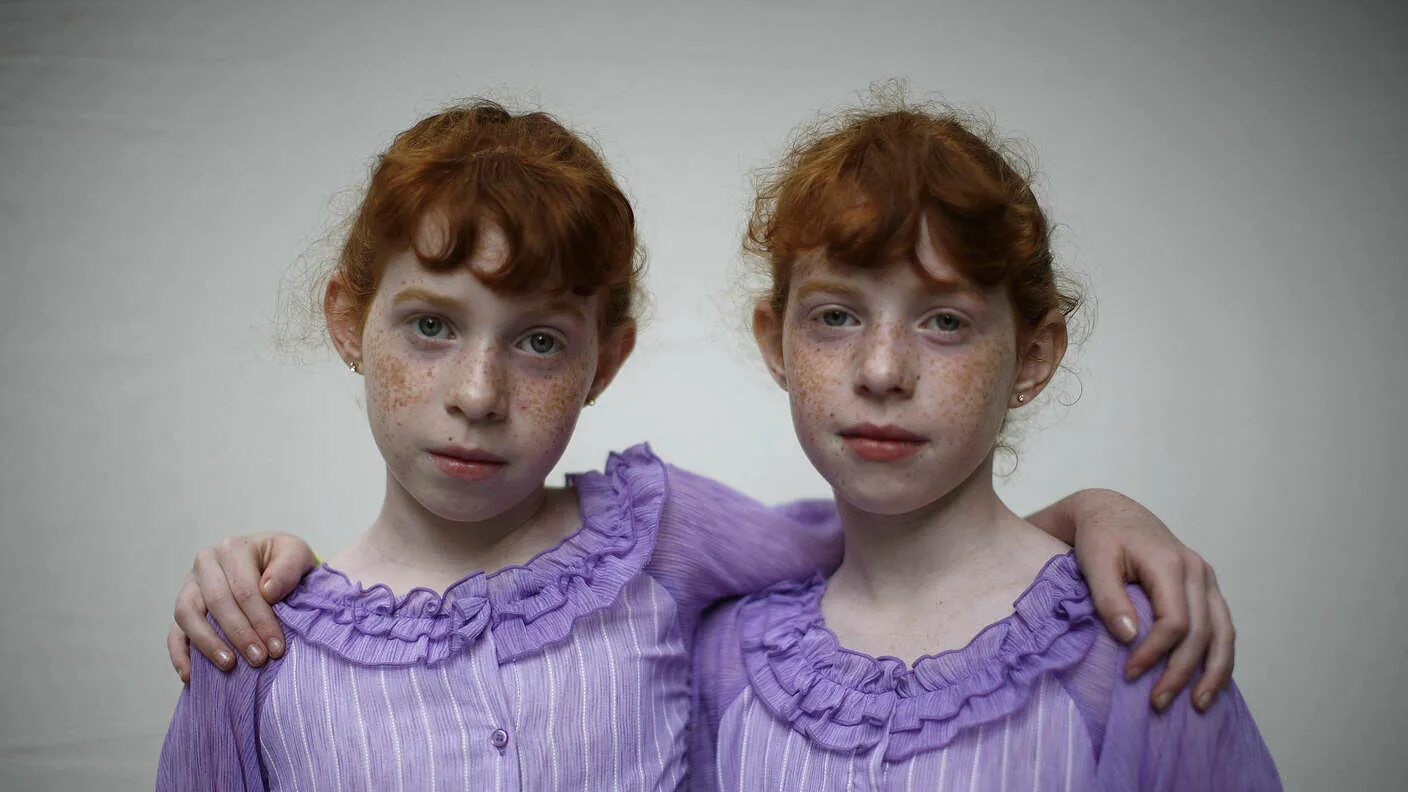 Невероятные похожие. Identical Twins / близняшки -. Сестры Кутеповы однояйцевые Близнецы. Одинаковые люди.