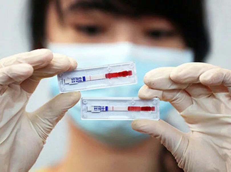 Хад спид. Тест на ВИЧ. Тестирование на ВИЧ инфекцию. Тест на ВИЧ И СПИД. Тест на ВИЧ картинки.