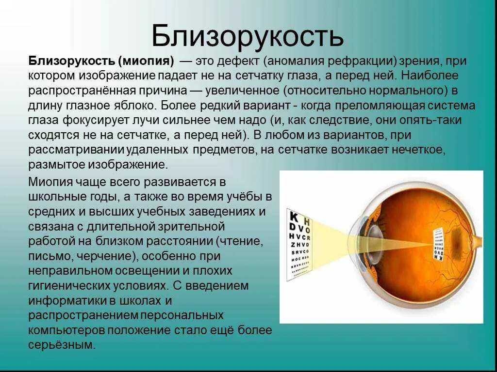 Человека с нарушением зрения называют. Близорукость. Близорукость миопия. Заболевание глаз миопия. Заболевание органов зрения миопия.