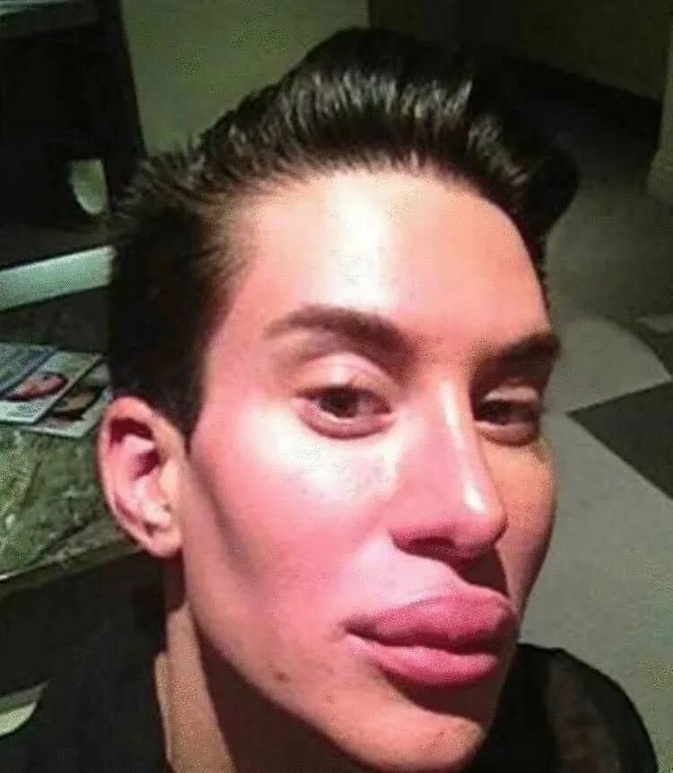 Мальчик с накаченными губами. Мальчик с накаченными губами. Парни накачивают губы. Парни накачивают губы. Мальчик с накаченными губами.