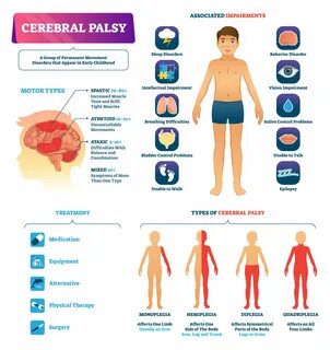 Cerebral palsy (CP) refers to a group of neurological disorders that appear...