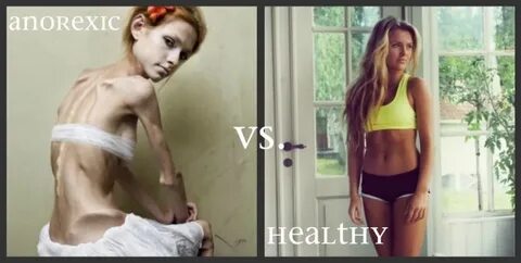 Healthy vs. anorexic get your thinspiration