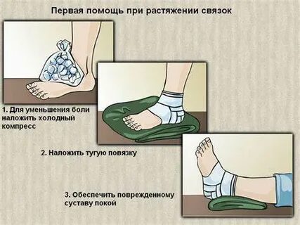 Что делать при вывихе ноги