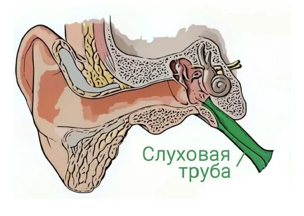Заложенность уха тубоотит. Воспаление слуховой евстахиевой трубы. Евстахиит барабанная перепонка. Евстахиит воспаление слуховой трубы.