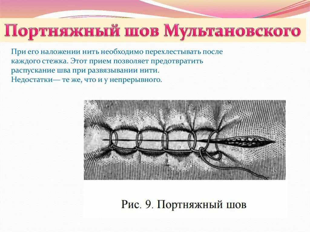 Шов Ревердена Мультановского. Шов Мультановского в хирургии. Шов Ревердена Мультановского техника. Техника наложения непрерывного шва. Как называется шов после операции