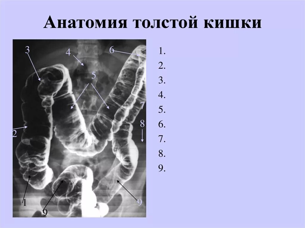 Ободочная кишка рентген анатомия. Рентген анатомия Толстого кишечника. Опухоль сигмовидной кишки рентген. Селезеночный угол ободочной кишки.