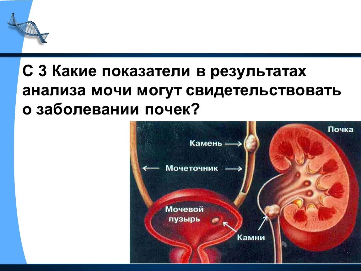 Показатели заболевания почек. Показатели почек в моче. О заболевании почек может свидетельствовать наличие в моче. Моча при патологии почек. Исследование мочи при заболеваниях почек.