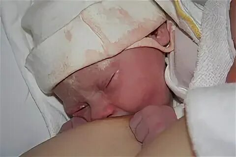 Что такое смегма у мальчиков