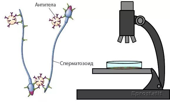 Антигены сперматозоидов и антитела к ним.. Антиспермальные антитела на сперматозоидах. Антитела к сперматозоидам у женщин. Антиспермальные антитела АСАТ. Иммунное бесплодие