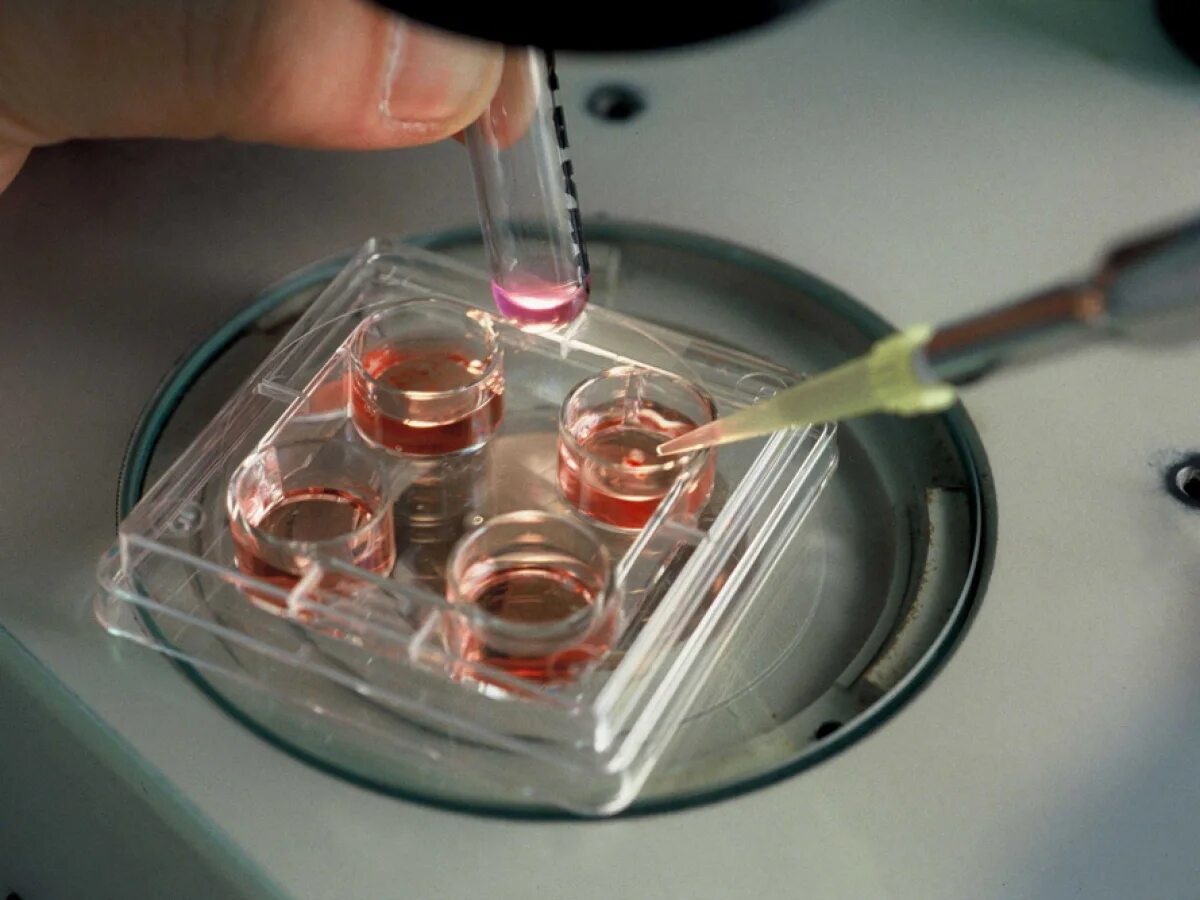 In vitro реагент. Культивирование клеток животных. Клетки in vitro. Культивирование эмбрионов.