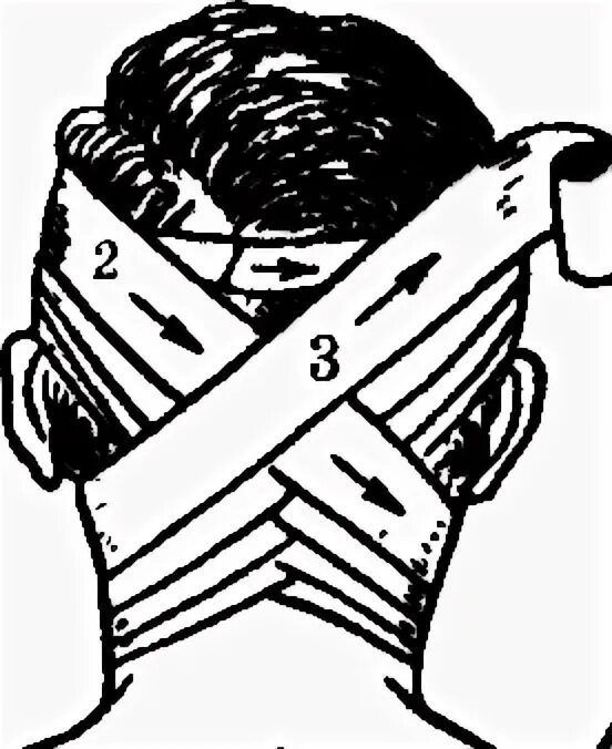 Техника наложения крестообразной повязки. Восьмиобразная повязка на затылок и шею. Крестообразная повязка алгоритм. Затылочная крестообразная повязка. Техника наложения восьмиобразной повязки на затылочную область.