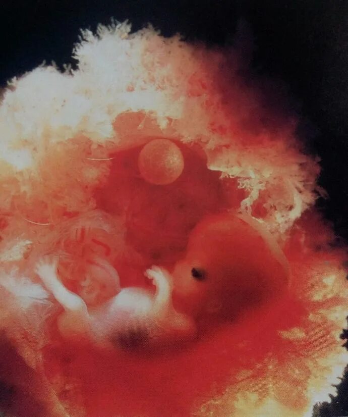 10 Недель беременности фото плода. Эмбрион на 10 неделе беременности фото. Плод ребенка 10 недель беременности фото. Плод в 8-10 недель беременности.