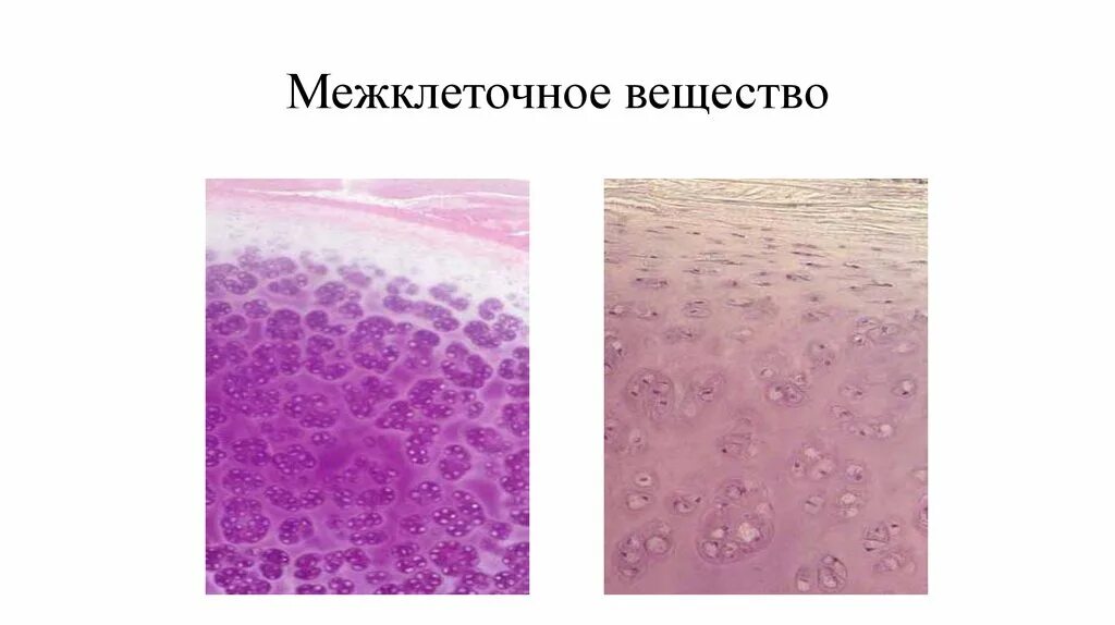 Межклеточное вещество находится. Межклеточное вещество хрящевой ткани гистология. Мезенхима межклеточное вещество. Межклеточное вещество гиалинового хряща. Межклеточное вещество препарат.