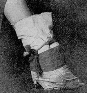 Колготкиде таралған аяқтардың фотосы