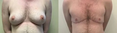 Slideshow: ftm with tits.