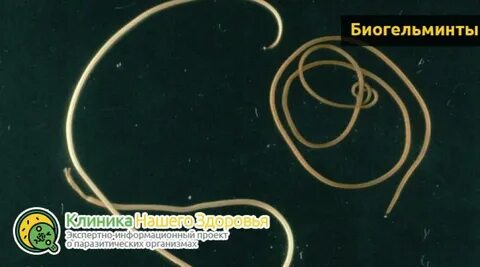 Круглые черви аскариды нематоды