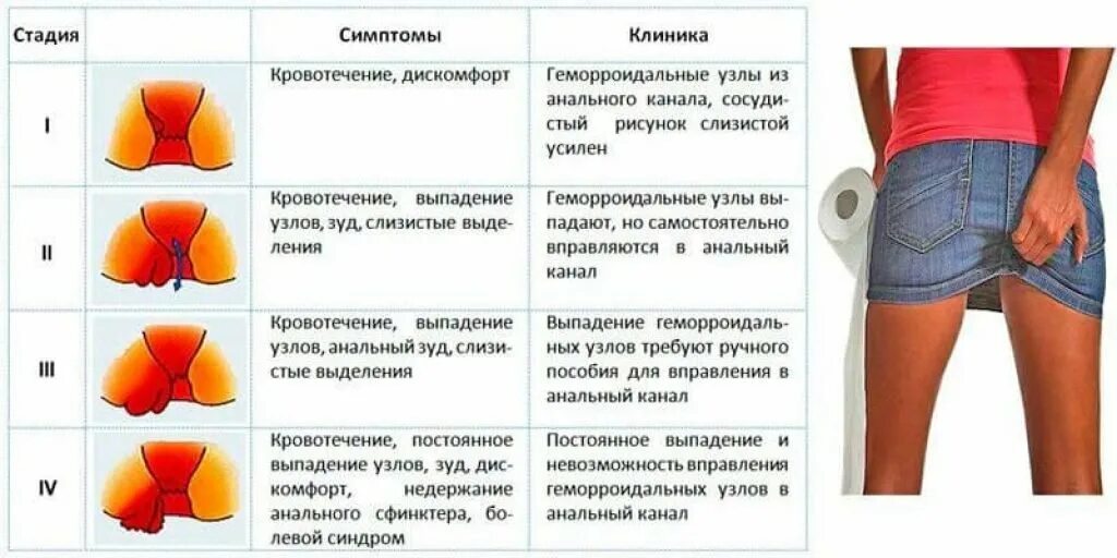 Можно ли избавиться от узлов