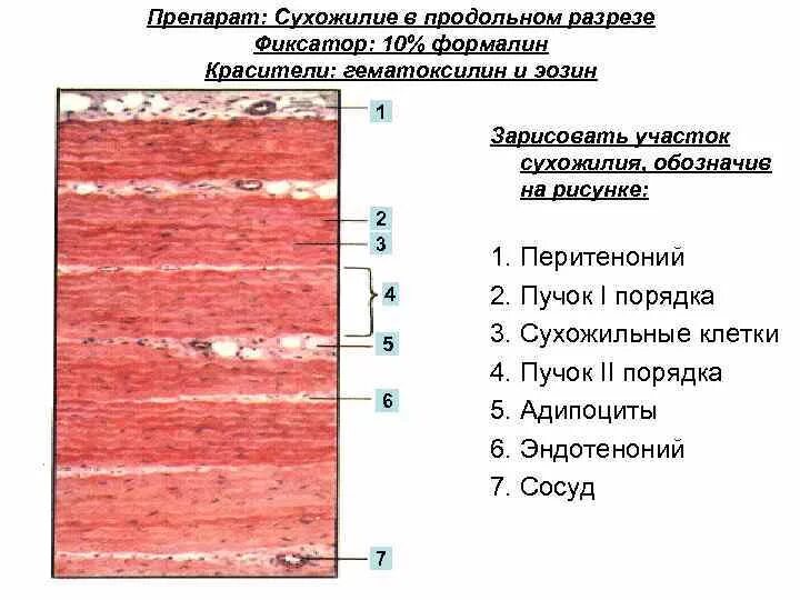 Эластическая связка
