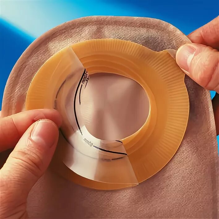 Как клеить стомы. Калоприемники альтерна 46316. трафарет для стомы coloplast. стома калоприемник манипуляция. наклеивание калоприемника.